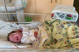 В Одессе медики спасли двух младенцев, которые весили менее 900 грамм В Одессе медики спасли двух младенцев, которые весили менее 900 грамм